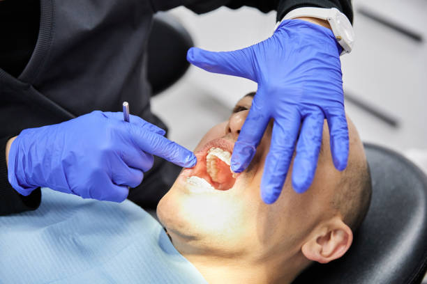 Best Emergency Broken Tooth Repair in Cambridge, WI